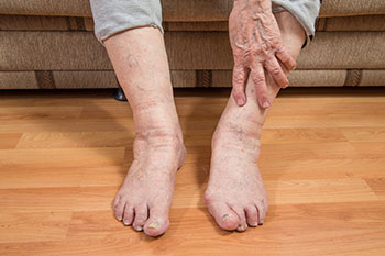 Geriatric Foot Care